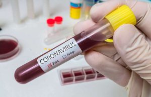 coronavirus-25-casos