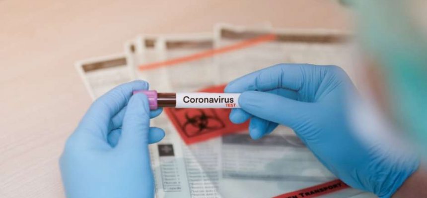 coronavirus