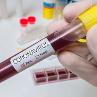 coronavirus-25-casos
